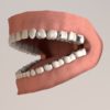 3d render of human teeth with fillings