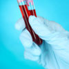 Test tubes with blood in hand on blue background