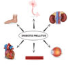 Diabetes mellitus affected organs